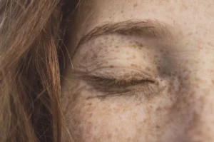 Mulher ruiva está de olhos fechados com muitas sardas no rosto. Na imagem, a foto explica o surgimento de pintas no corpo.